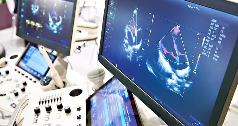 Medical imaging equipment with multiple monitors displaying diagnostic images